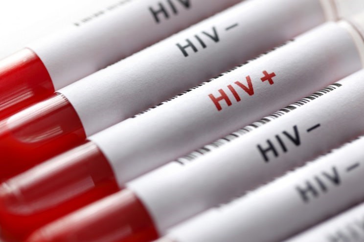 آزمایش ایدز رایگان و محرمانه انجام می‌شود/ ازدواج و اشتغال 2 چالش اجتماعی مبتلایان HIV